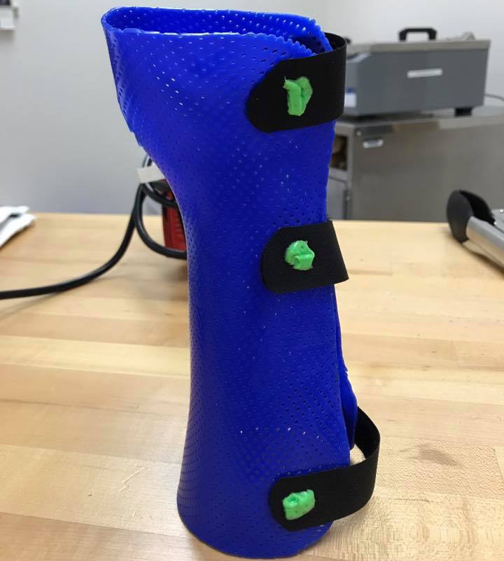Blue orthosis with black hook-and-loop strapping