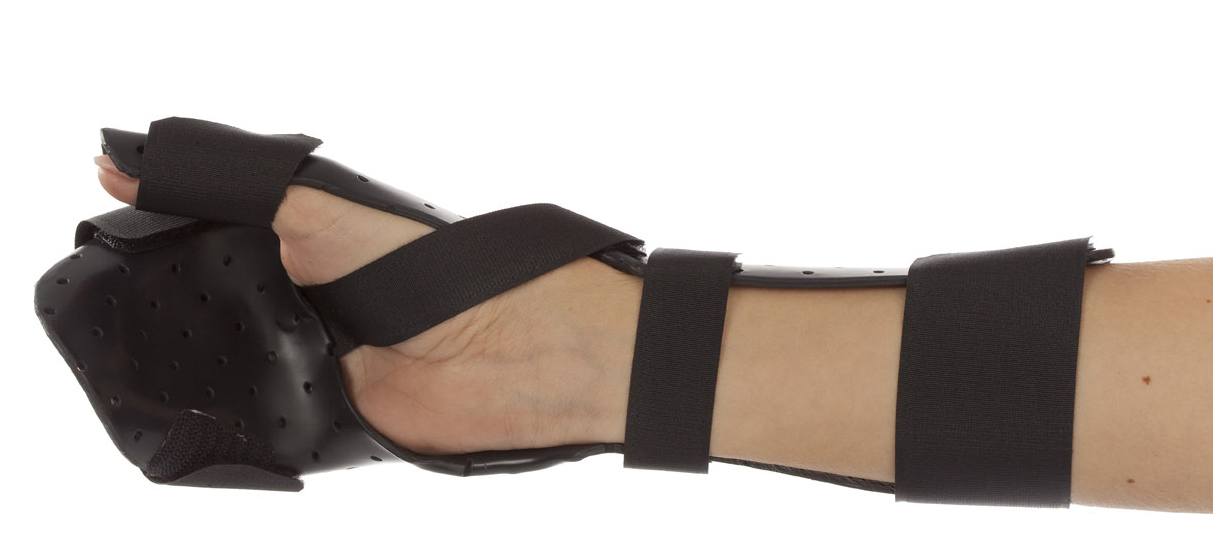 Static orthosis for spasticity.