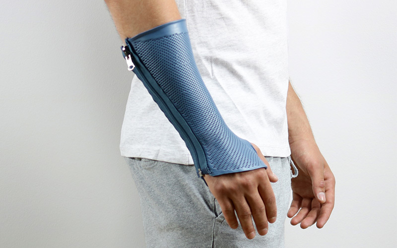 Circumferential wrist splint for sports injuries to the wrist.