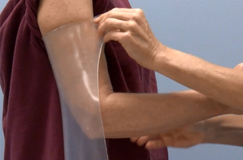 Process of moulding a thermoplastic elbow orthosis