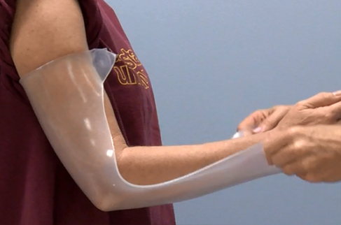 Process of moulding a thermoplastic elbow orthosis
