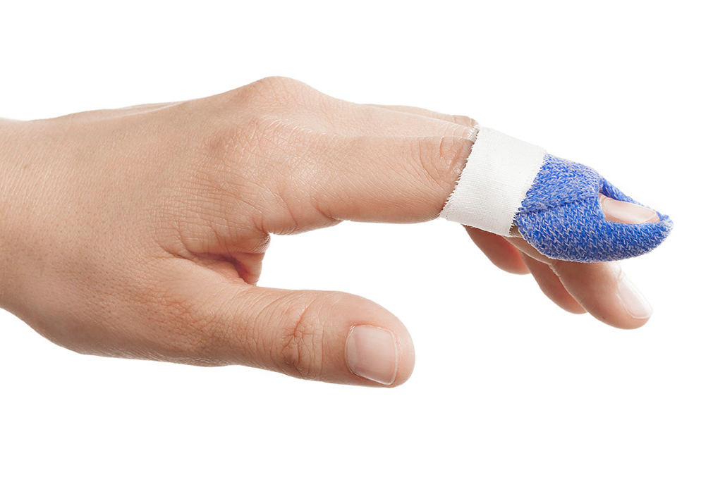 Hand with a mallet finger orthosis in Orficast blue