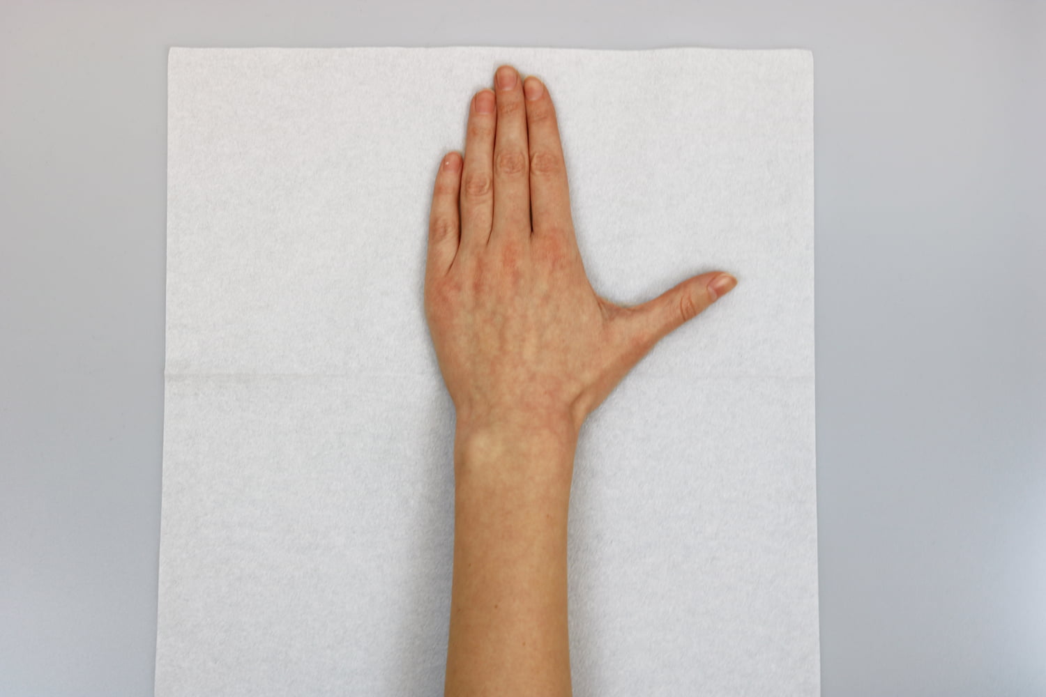 Hand positioned on a paper towel to make a pattern for an orthosis.